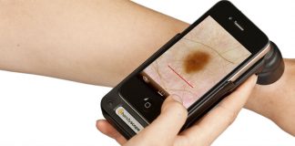 Ce este cauterizarea si la ce se foloseste?