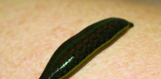 Lipitorile (Hirudo medicinalis) – sansa unei sanatati perfecte