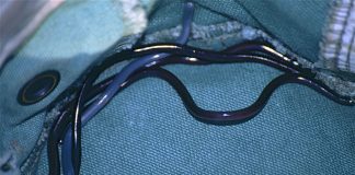 Șarpele orb al brahmanului (Ramphotyphlops braminus), are obiceiul de a se ascunde în ghivece