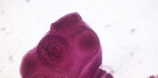 Clasa Cestoda, tenia răspândită în toată lumea