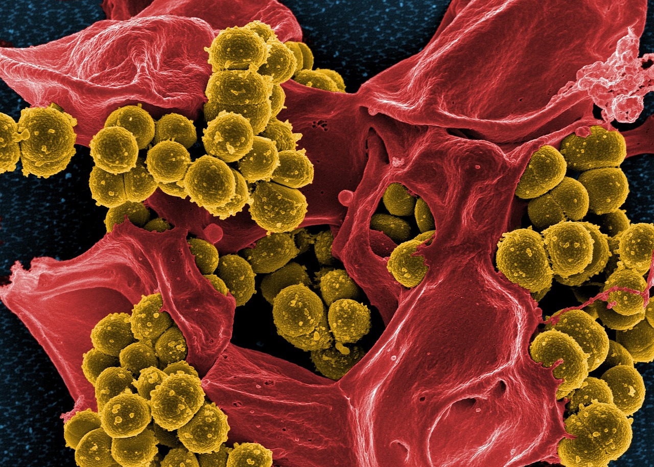 Staphylococcus aureus11