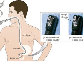 Endoscopie