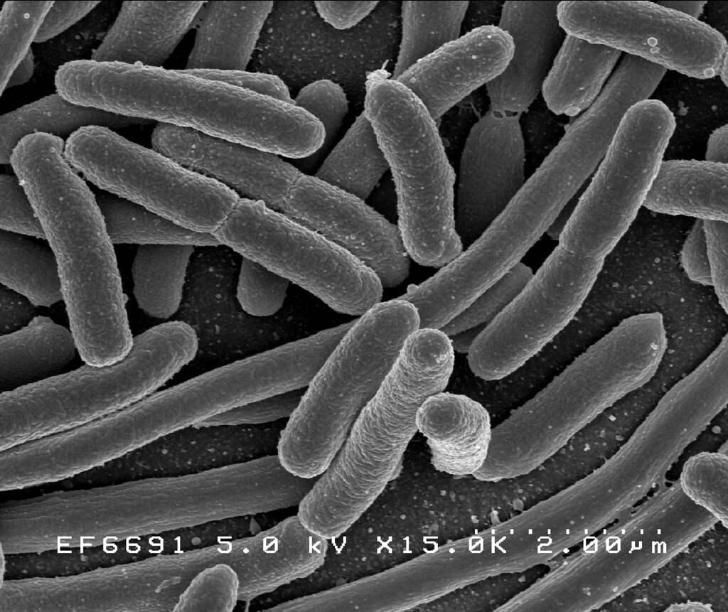 Bacteria cu e.coli