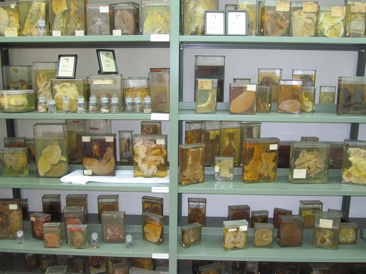 Anatomia patologica