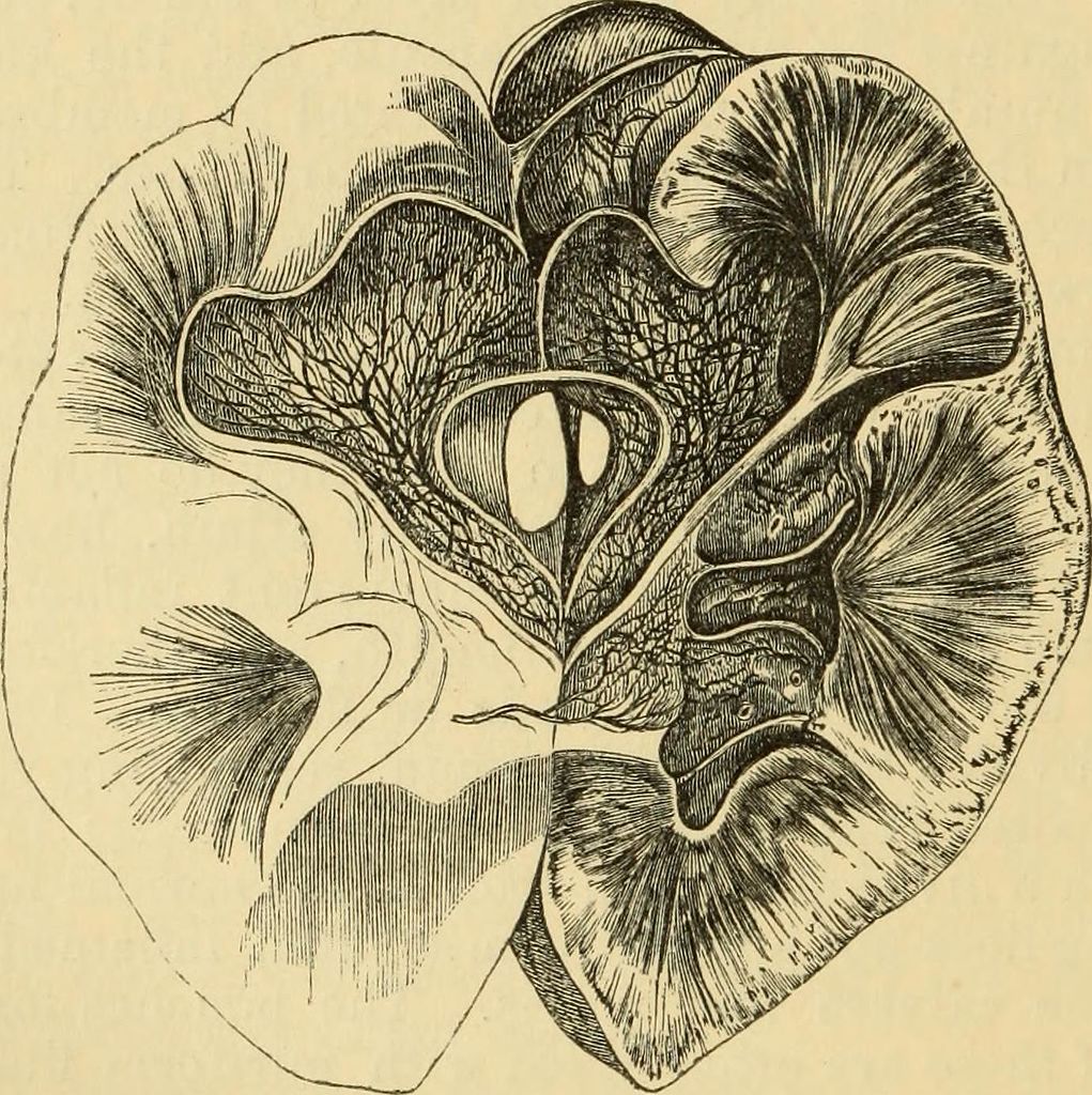 Anatomia patologica11