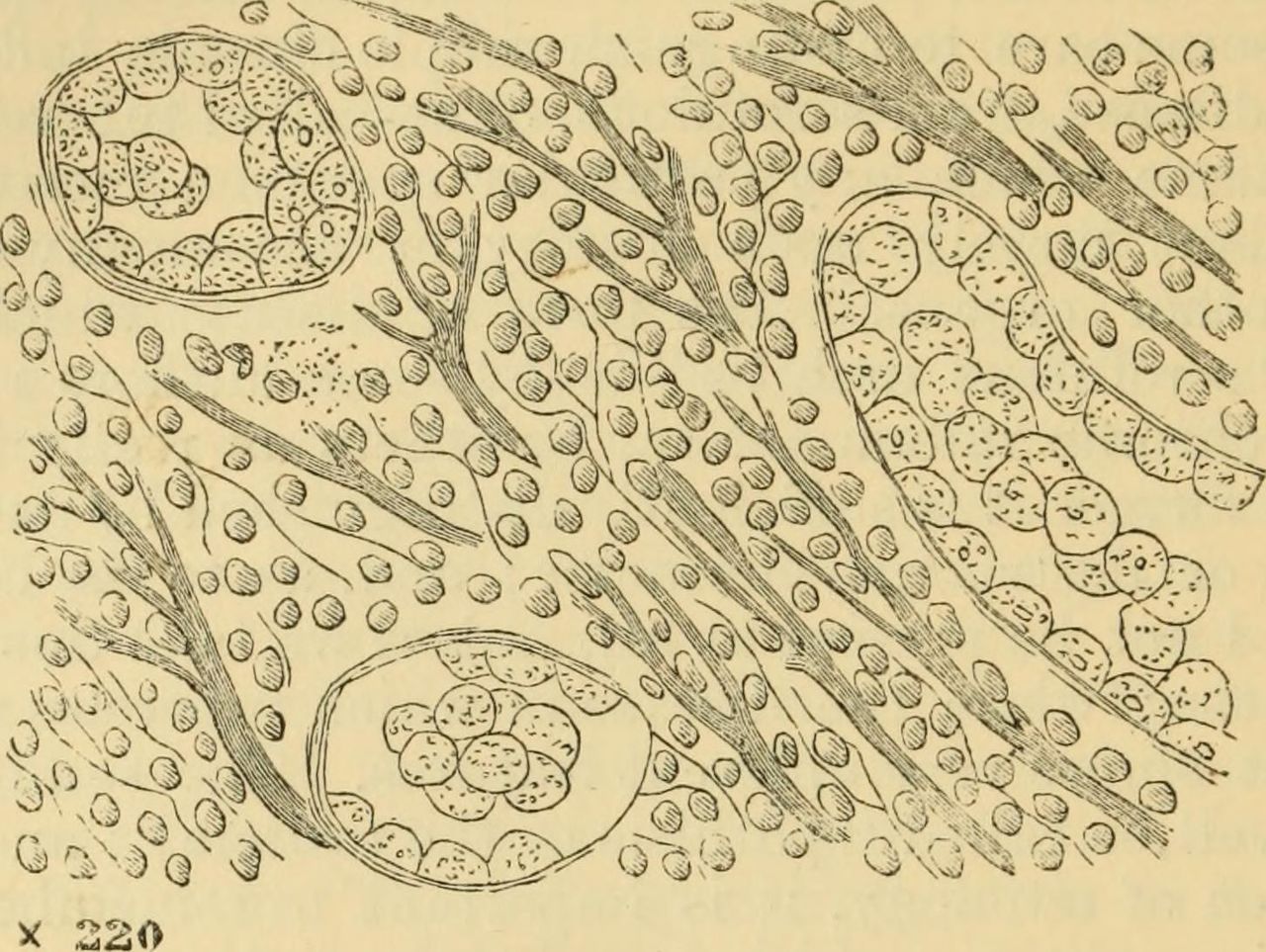 Anatomia patologica111