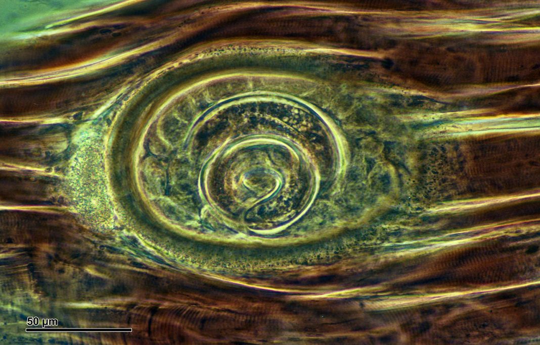 Adenofori, viermi inelați - Trichinela, cel mai des întâlnită la porci