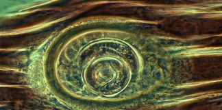 Adenofori, viermi inelați - Trichinela, cel mai des întâlnită la porci