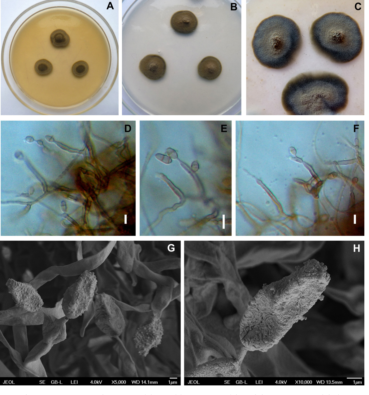 Ochroconis anomala