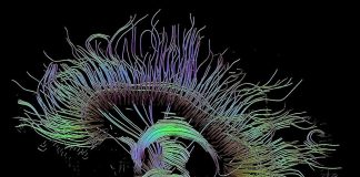 Neuro-Linguistic Programming (NLP) sau Programarea Neuro-Lingvistică – eliminarea blocajelor mentale Neuro-Linguistic Programming