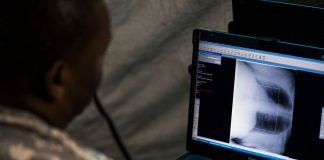 Utilizarea razelor X și prima radiografie din istorie – o descoperire accidentală Raze X