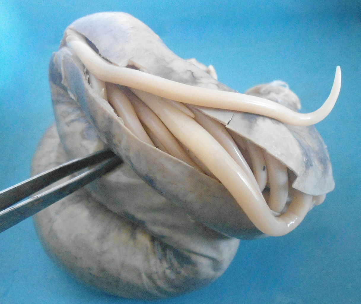 Ascaris lumbricoides