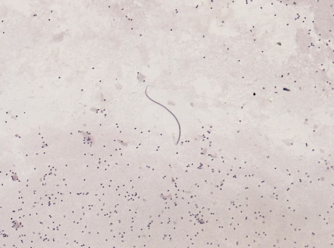 Secernenteeni, specii de viermi cilindrici Secernenteeni, specii de viermi cilindrici