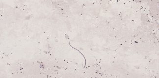 Specii de viermi cilindrici secernenteeni: habitat, caracteristici și impact Secernenteeni, specii de viermi cilindrici