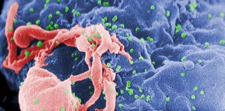 Frica naşte minciuni – Legende urbane despre virusul HIV și SIDA HIV