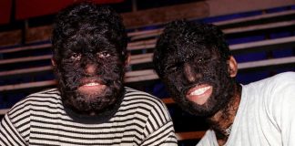 Afectiuni medicale bizare