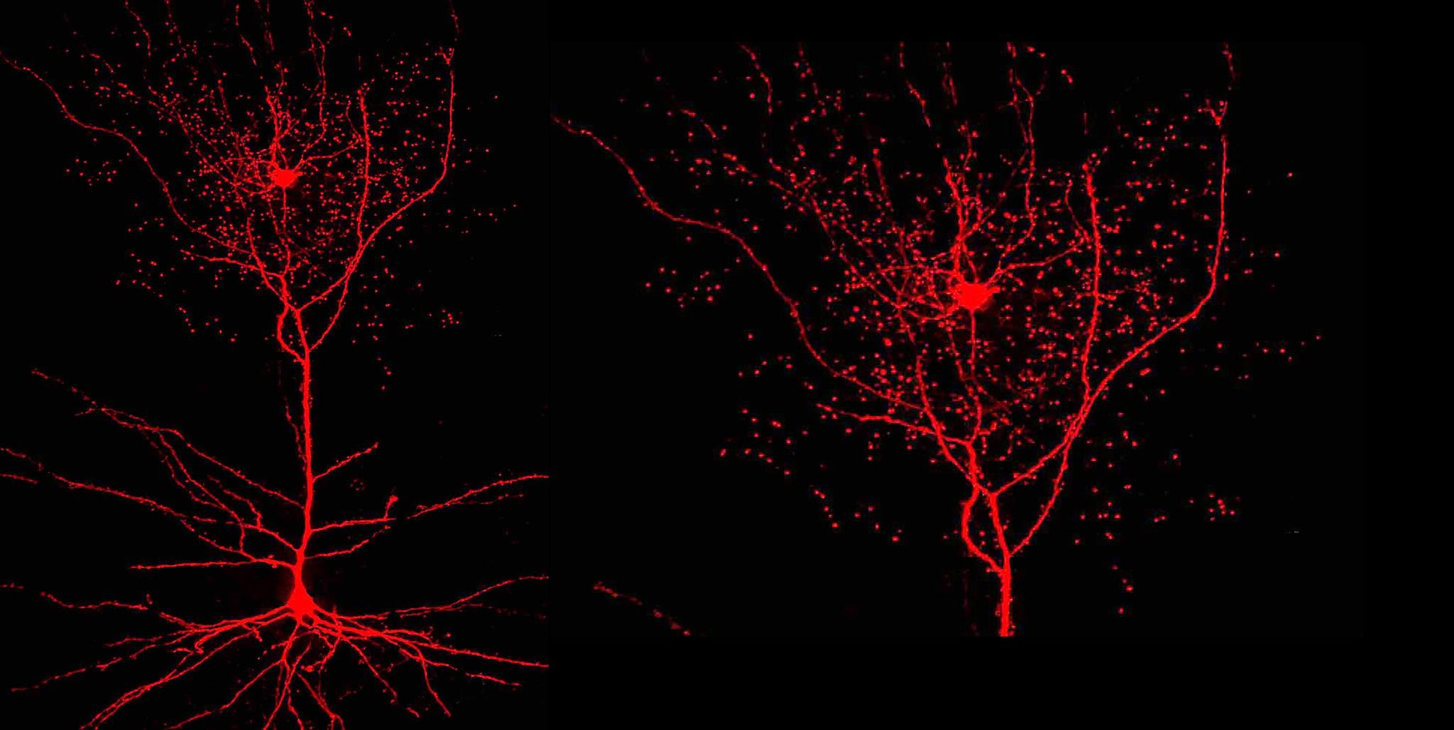 Neuronul rosehip sau neuronul cynorhodon