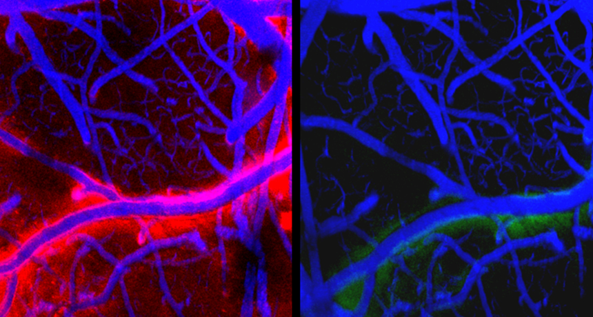 Lichidul cefalorahidian spala creierul, Sursa: Science News