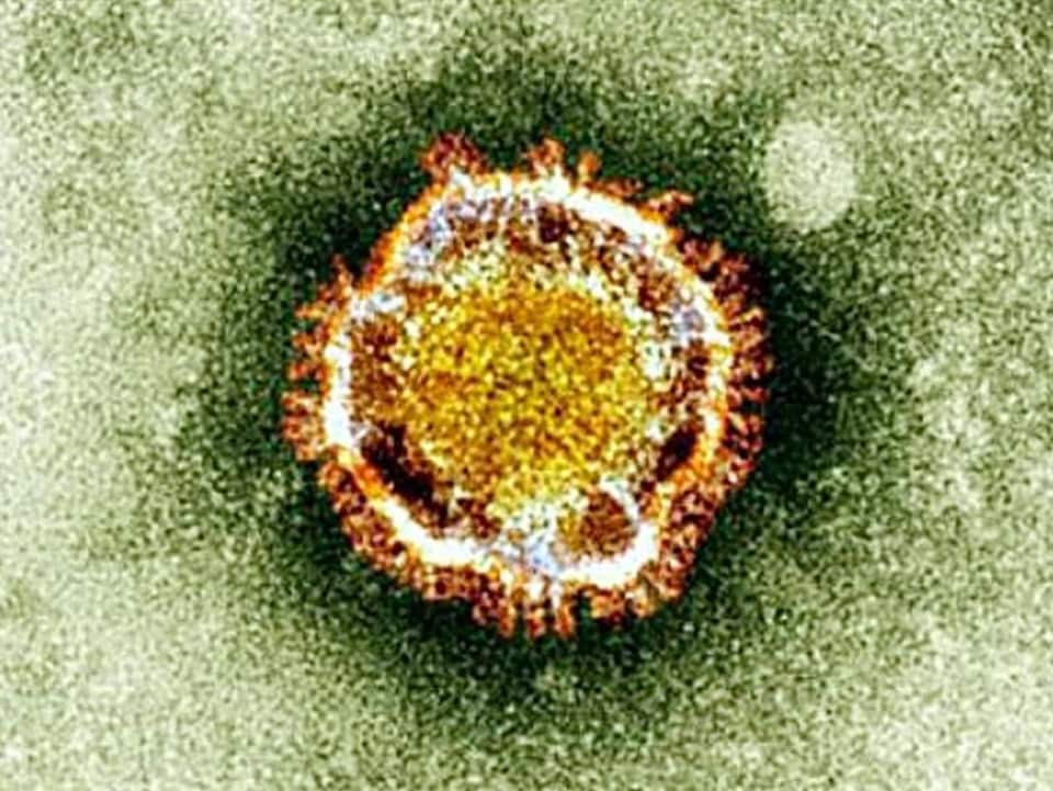 Coronavirus, SARS