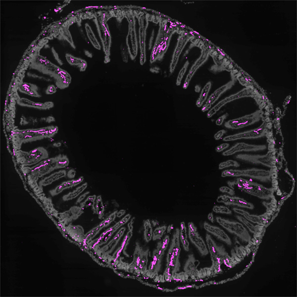 Neuroni intestinali, Sursa Harvard Medical School