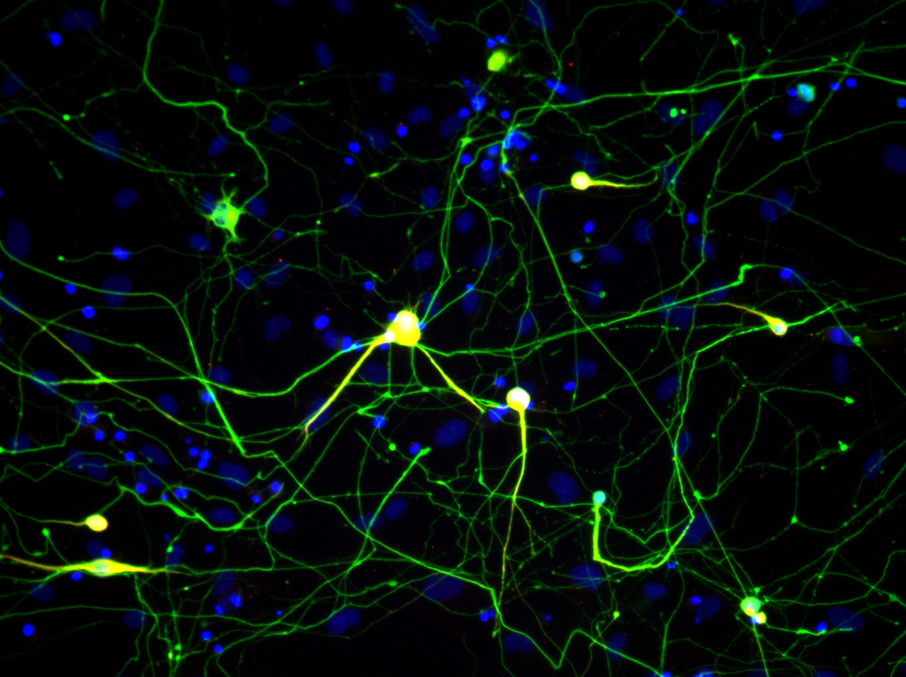 Celule nervoase in piele, Sursa Salk Institute