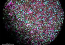 Inteligenţa Organoidă (OI), Imagine mărită a unui organoid cerebral produs în laboratorul lui Thomas Hartung