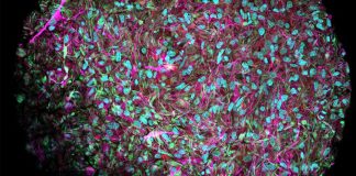 Inteligenţa Organoidă (OI) – “noua frontieră”, pentru a merge mai departe decât ChatGPT. Computere cu creier uman Inteligenţa Organoidă (OI), Imagine mărită a unui organoid cerebral produs în laboratorul lui Thomas Hartung