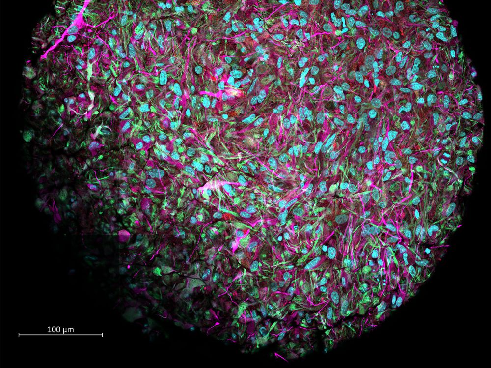 Inteligenţa Organoidă (OI), Imagine mărită a unui organoid cerebral produs în laboratorul lui Thomas Hartung